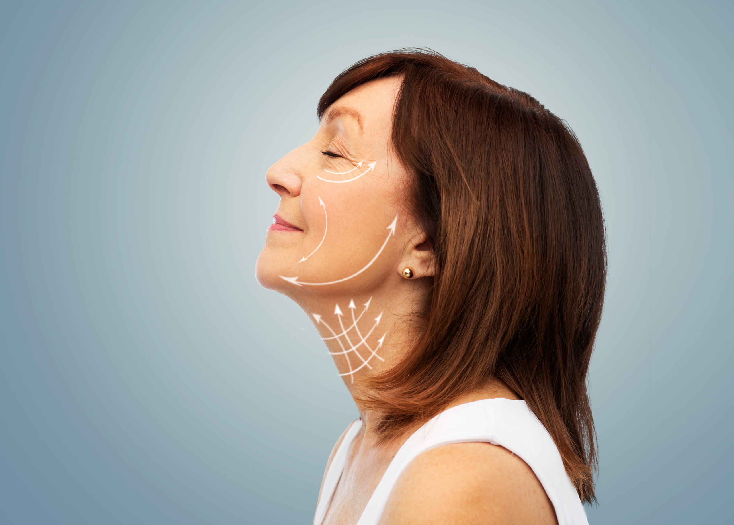 A visual representation of the affects of facelift from a Guide to Facelift surgery